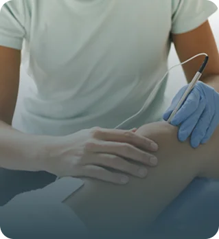 Electroacupuntura / Neuromodulación